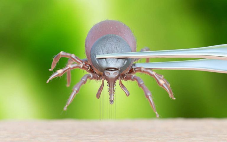 How to safely remove a tick ascend healthy