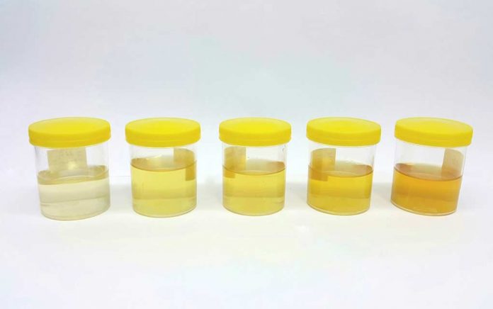 What-the-Color-of-Your-Pee-is-Telling-You What the Color of Your Pee is Telling You