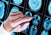 5 Startling Facts About Epilepsy