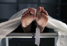 The Truth About Donating Your Body to Science Revealed