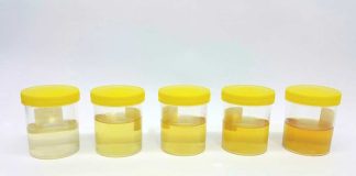 What the Color of Your Pee is Telling You