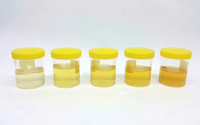What-the-Color-of-Your-Pee-is-Telling-You What the Color of Your Pee is Telling You