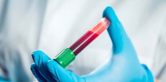 Blood Type an Illness: What Conditions Are You at Risk For?
