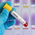 Deadly Listeria Outbreak: Are You at Risk? Deadly Listeria Outbreak: Are You at Risk?