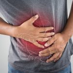 How to Detect Colon Cancer Without a Colonoscopy How to Detect Colon Cancer Without A Colonoscopy