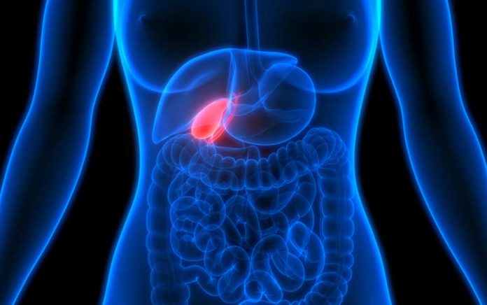 Gallbladder-Health-9-Surprising-Signs-Something-Is-Wrong Gallbladder Health: 9 Surprising Signs Something Is Wrong