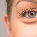 Eye Bags Be Gone! Natural Remedies for Tired Eyes Eye Bags Be Gone! Natural Remedies for Tired Eyes