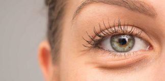 Eye Bags Be Gone! Natural Remedies for Tired Eyes